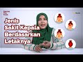 Berbagai Jenis Sakit Kepala Serta Penyebab Dan Cara Mengatasinya