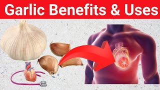 Benefits of Garlic: You Won