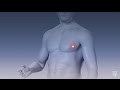 Mayo Clinic Minute Breast Cancer Strikes Men Too