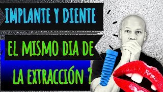 SE PUEDE COLOCAR un IMPLANTE el mismo DIA de la EXTRACCIÓN 