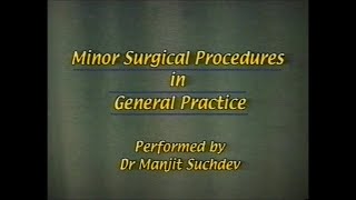 Minor Surgical Procedures in General Practice