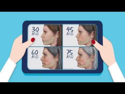 comment augmenter sa masse osseuse