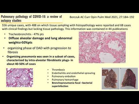#1 Pulmonary Rehabilitation. Simeox Therapy in Post Covid-19 Patients  - PhysioAssist