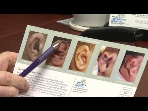 EAR MOLDING FOR BABIES