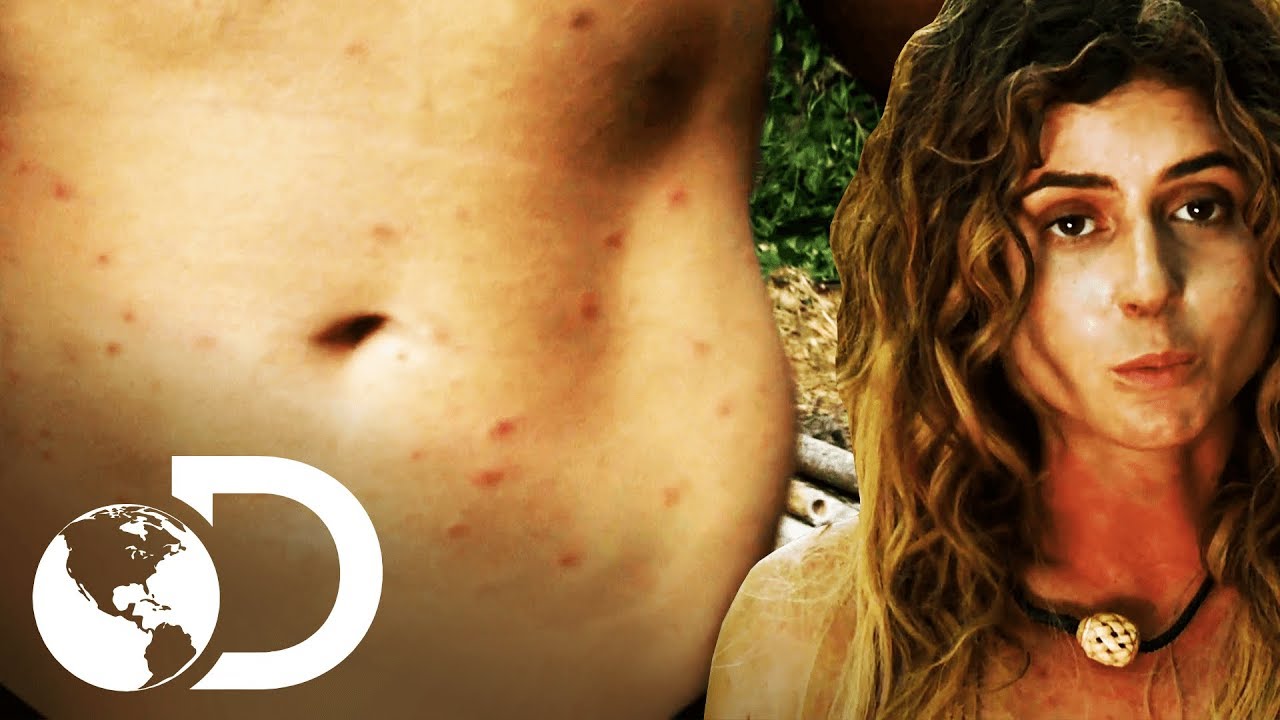 Deja el desafío a causa de los mosquitos | Supervivencia al desnudo | Discovery Latinoamérica
