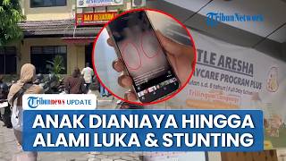 Pengakuan Orangtua Korban Daycare Jogja: Anak Dianiaya Alami Luka Fisik & Stunting Selama