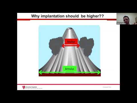 Ultimate Aortic Cases- CVI 2020 CME Webcast Series