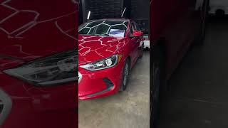 Hyundai Elantra Remote Start: Easy Morning Boost! #Shorts