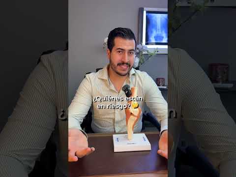 Hay personas con los huesos así de frágiles 😳🦴#drravelo #Traumatólogo #ortopedia #médico #huesos