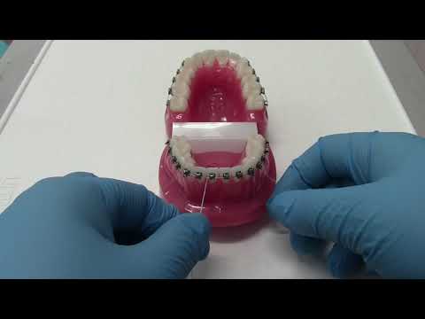 How to Use Superfloss