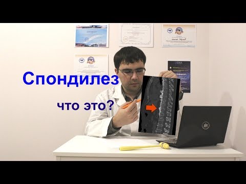Упражнения при болях в спине и ногах Как лечить остеохондроз лопатки