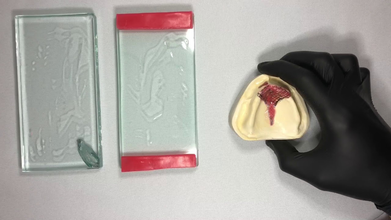 Confecção de Moldeira Individual para Prótese Total