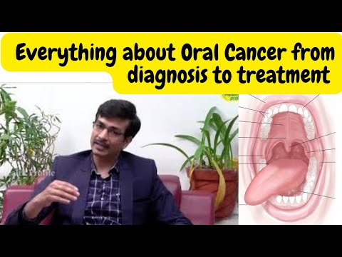 Oral Cancer ( Answering 7 Questions on Oral Cancer)