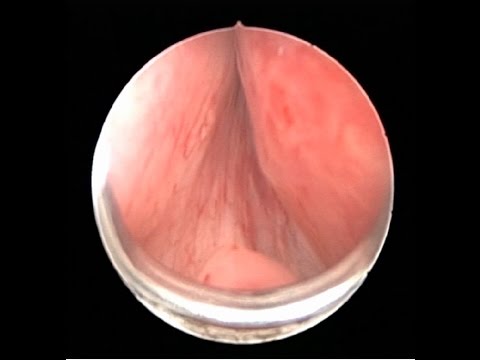 Annunci privati fanno massaggio prostatico a San Pietroburgo Tasso di microscopia di succo della prostata
