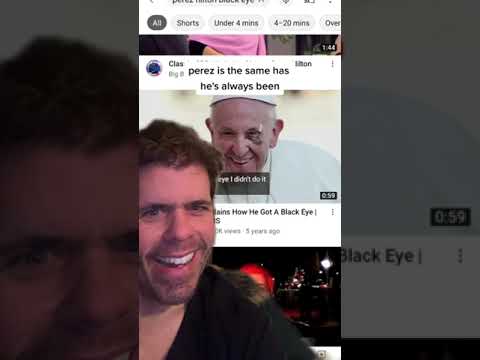 Perez Hilton Has Panda Eyes! | The Black Eye  Club
