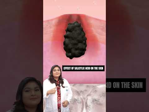 Episalic Ointment 20 mg (PCD Brand)