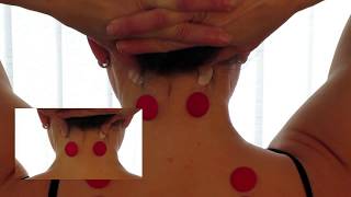 How to Stop Headaches and Migraines Instantly (The 1 Minute Effects with Pressure Points!)