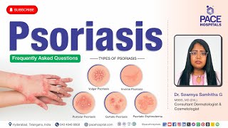 Psoriasis Skin Disease | Psoriasis - Types, Triggers, Symptoms, Diagnosis, Treatment & Diets