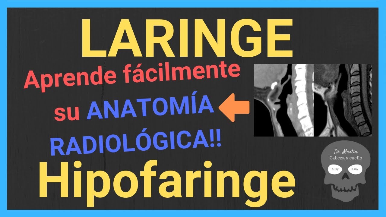 🤖Anatomía LARINGE (TAC y RM)...también HIPOFARINGE!!🤪