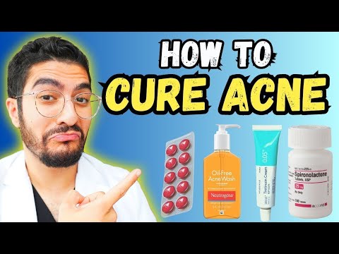 99% Overlook These Effective Acne Treatments – 2025 Guide