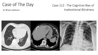 Case of the Day - 112 - 2025 10 01 - The Cognitive Bias of Inattentional Blindness