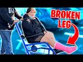 IZZY Broke Her LEG