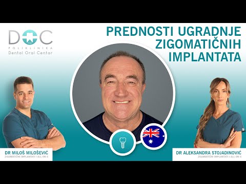Prednosti zigomatičnih implantata - iskustvo pacijenta - dr Miloš Milošević