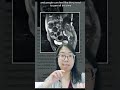 What Happens To The Space Where The Uterus Was After A HYSTERECTOMY Gynecologist Explains Short
