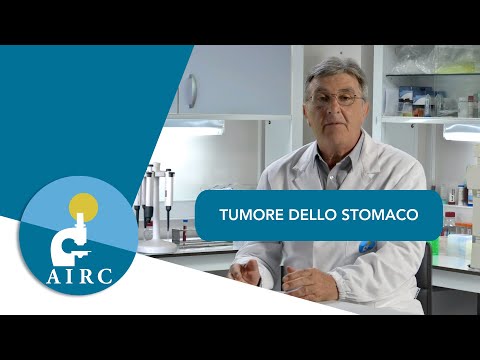 Tumore dello stomaco: sintomi, prevenzione, cause, diagnosi | AIRC