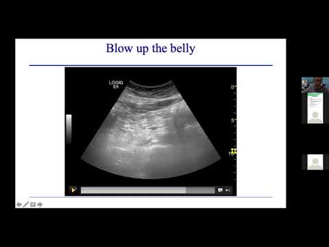 WFUMB EFSUMB Student Webinar 07 October 2021