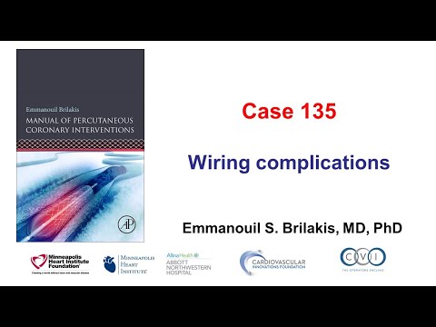 Case 135: PCI Manual - Wiring challenges