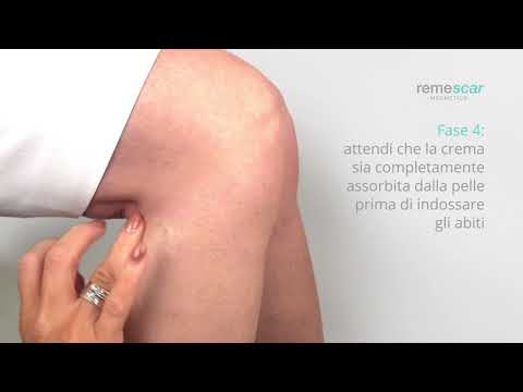Artralgia della temporomandibolare ICD-10 giunto Lesione del rachide cervicale nei neonati