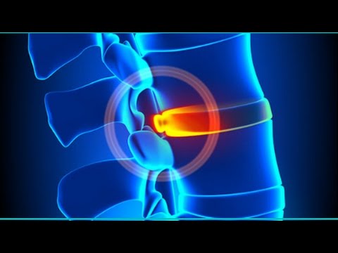 Spalla immagine di anatomia congiunta Un intervento chirurgico per sostituire un ginocchio