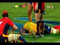 World Rugby Nations Cup Romania Vs Spania