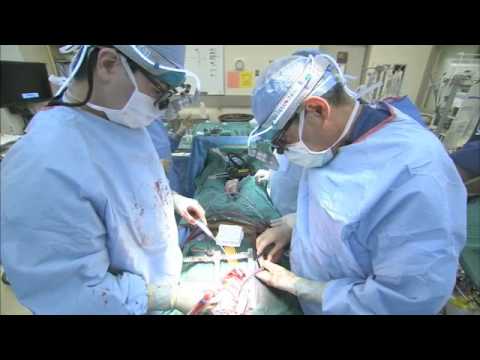 Coronary Artery Bypass Surgery - Part3