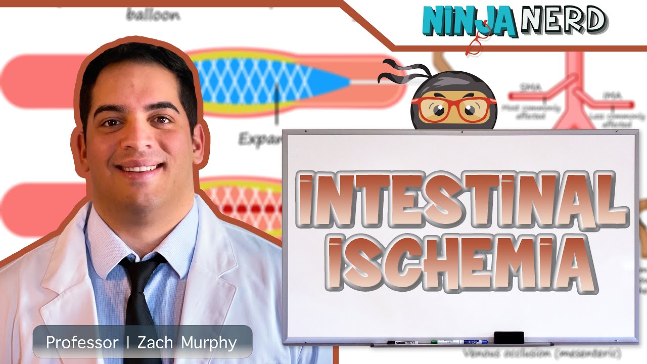 Intestinal Ischemia | Clinical Medicine
