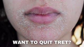 WATCH THIS BEFORE QUITTING RETIN-A | PURGING, DRYNESS, ACNE AND ANTI-AGING