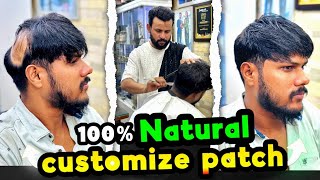 Customized Hair Patch Result! Natural & Stylish Transformation | Rizy Hair Solution | 9599858612 