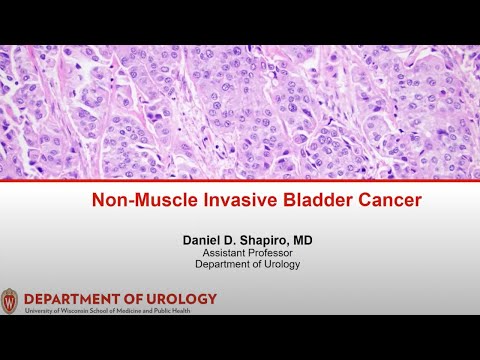 UW Urology Grand Rounds: Non-Muscle Invasive Bladder Cancer - 9/14/2022