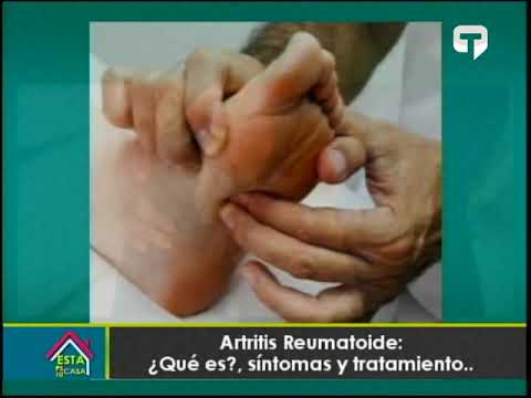 Artritis reumatoide: ¿Qué es?, síntomas y tratamiento