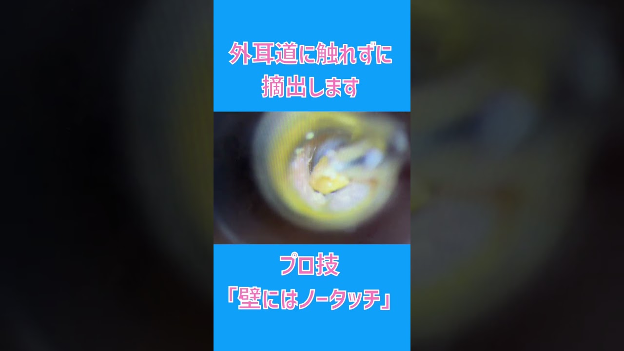 壁にはノータッチ　＃耳垢　＃耳掃除　 #shorts