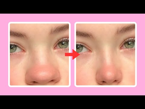 easy nose slimming exercises, reshape your nose in just 7 days!