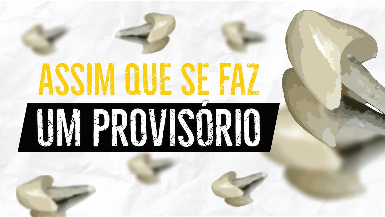 Como fazer um provisório | PRÓTESE FIXA