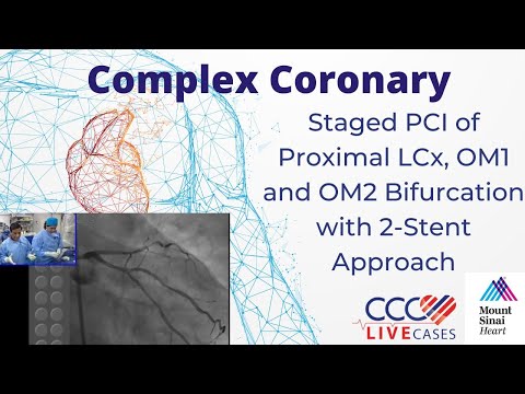 Staged PCI of Proximal LCx, OM1 and OM2 Bifurcation with 2-Stent Approach - November 2014 Webcast