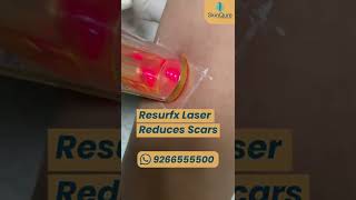 Get freedom from acne scars,  wrinkles, stretch marks, dull skin and pigmentation with ResurFX Laser