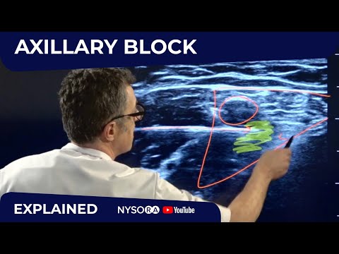 Axillary Brachial Plexus Block - Regional anesthesia Crash course with Dr. Hadzic