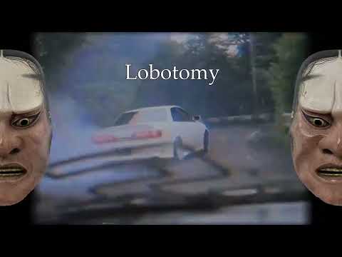RAUDI.$tuart - Lobotomy