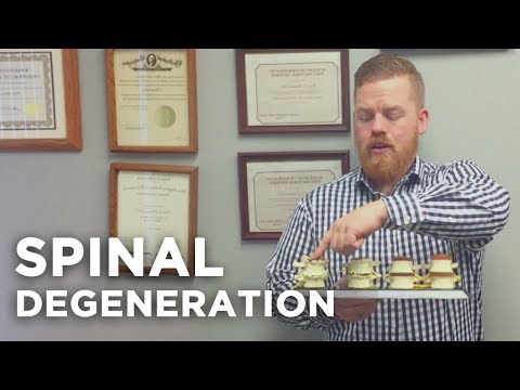 What is Spinal Degeneration?