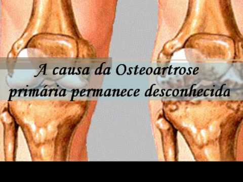 Il trattamento dei spinale Laser Therapy Il miele da un infortunio congiunto
