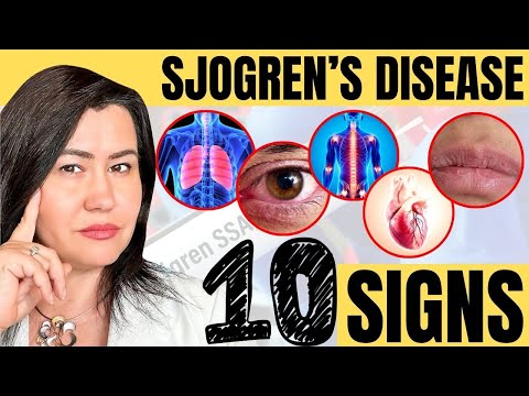 , title : '10 Signs of Sjogren's Syndrome - a very complex autoimmune disease'